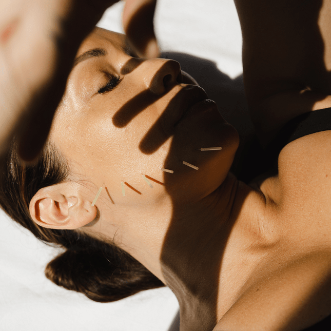 Facial acupuncture treatment at Balance Health Hong Kong, practitioner applying fine needles to face for natural beauty, skin rejuvenation, and holistic wellness.